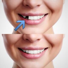 Temporary Tooth Repair Kit Fix